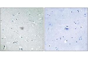 Immunohistochemistry analysis of paraffin-embedded human brain tissue, using PE2R3 Antibody. (PTGER3 Antikörper  (AA 1-50))