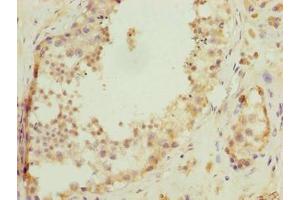 Immunohistochemistry of paraffin-embedded human testis tissue using ABIN7174751 at dilution of 1:100 (C17ORF47 Antikörper  (AA 1-300))