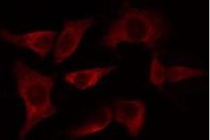 ABIN6275106 staining HeLa cells by IF/ICC. (ELOVL4 Antikörper  (Internal Region))