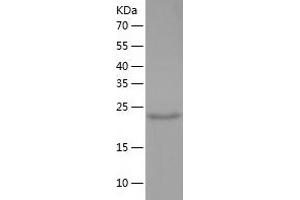 ALDH3B2 Protein (AA 56-288) (His tag)