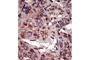 Image no. 2 for anti-Diacylglycerol Kinase, alpha 80kDa (DGKA) (C-Term) antibody (ABIN360612) (DGKA Antikörper  (C-Term))