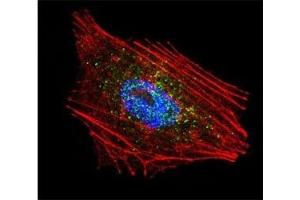 Confocal immunofluorescent analysis of Parkin antibody with NCI-H460 cells followed by Alexa Fluor 488-conjugated goat anti-rabbit lgG (green).