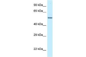 WB Suggested Anti-ZNF384 Antibody Titration: 1. (ZNF384 Antikörper  (C-Term))