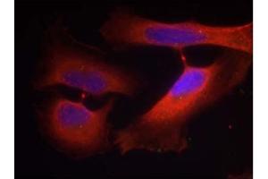 Image no. 1 for anti-Keratin 8 (KRT8) (pSer74) antibody (ABIN401538) (KRT8 Antikörper  (pSer74))