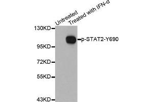 Western blot analysis of extracts from Hela cells using Phospho-STAT2-Y690 antibody. (STAT2 Antikörper  (pTyr690))
