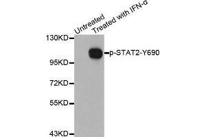 Western blot analysis of extracts from Hela cells using Phospho-STAT2-Y690 antibody.