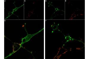 Live cell imaging of Stichodactyla Toxin-ATTO Fluor-590 in differentiated  cells.