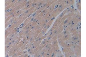 Immunohistochemistry (IHC) image for anti-Olfactomedin 4 (OLFM4) (AA 238-500) antibody (ABIN7431236)