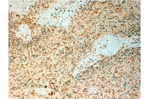 Immunohistochemistry: TET2 Antibody staining of Paraffin Embedded Human Spleen at 4 µg/ml. (TET2 Antikörper  (Internal Region))
