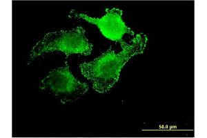 Immunofluorescence of monoclonal antibody to UNC5CL on HeLa cell. (UNC5CL Antikörper  (AA 1-518))