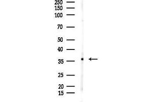 anti-RNA-binding protein Raly (RALY) (Internal Region) antibody
