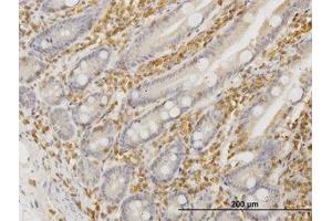 Image no. 4 for anti-Hematopoietic Cell-Specific Lyn Substrate 1 (HCLS1) (AA 266-356) antibody (ABIN598726) (HCLS1 Antikörper  (AA 266-356))