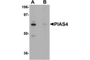Western blot analysis of PIAS4 in rat brain tissue lysate with PIAS4 antibody at 1 μg/ml in (A) the absence and (B) the presence of blocking peptide.