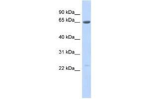 WB Suggested Anti-SSX7 Antibody Titration:  0. (SSX7 Antikörper  (Middle Region))