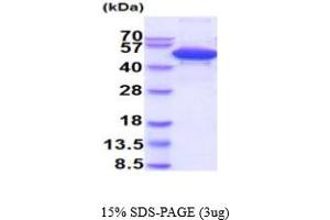 SDS-PAGE (SDS) image for Cleavage Stimulation Factor, 3' Pre-RNA, Subunit 1, 50kDa (CSTF1) (AA 1-431) protein (His tag) (ABIN5854876) (CSTF1 Protein (AA 1-431) (His tag))