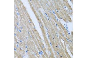 Immunohistochemistry of paraffin-embedded mouse heart using CCM2 antibody. (CCM2 Antikörper  (AA 1-300))