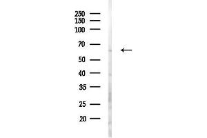Western blot analysis of lysates from Hela cells(LPS,4h treatment), using USP22 Antibody at 1/1000 dilution.