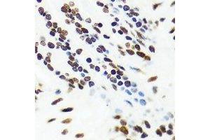 Immunohistochemistry (IHC) image for anti-Vaccinia Related Kinase 1 (VRK1) antibody (ABIN7308494) (VRK1 Antikörper)