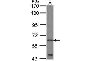 WB Image Sample (30 ug of whole cell lysate) A: JurKat 7. (GLIS1 Antikörper  (C-Term))