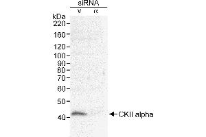 Western Blotting (WB) image for anti-Casein Kinase 2 alpha 1 (CSNK2A1) (AA 1-50) antibody (ABIN7452878) (CSNK2A1/CK II alpha Antikörper  (AA 1-50))