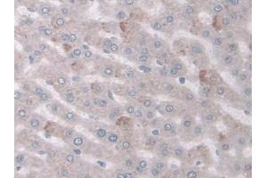 DAB staining on IHC-P; Samples: Rat Liver Tissue (COX-1 Antikörper  (AA 23-277))