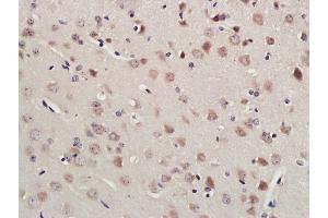 Paraformaldehyde-fixed, paraffin embedded Mouse brain; Antigen retrieval by boiling in sodium citrate buffer (pH6.