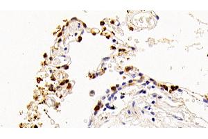 Detection of SPA2 in Human Lung Tissue using Polyclonal Antibody to Surfactant Associated Protein A2 (SPA2) (SFTPA2 Antikörper  (AA 21-114))