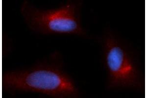 Immunofluorescence (IF) image for anti-Glutamine--Fructose-6-Phosphate Transaminase 1 (GFPT1) (AA 332-699) antibody (PE) (ABIN5568374) (GFPT1 Antikörper  (AA 332-699) (PE))