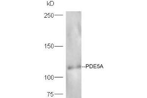 Lane 1: mouse heart probed with Rabbit Anti-Axin1 Polyclonal Antibody, Unconjugated (ABIN740295) at 1:300 overnight at 4 °C. (Axin Antikörper  (AA 761-862))