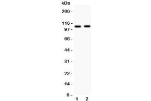 Western blot testing of Nod1 antibody and Lane 1:  human A549;  2: rat heart lysate. (NOD1 Antikörper  (AA 1-160))