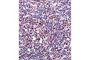 Immunohistochemistry (IHC) image for anti-Runt-Related Transcription Factor 2 (RUNX2) antibody (ABIN3003461) (RUNX2 Antikörper)