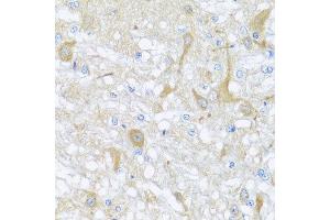 Immunohistochemistry of paraffin-embedded rat brain using SULT1A1 antibody at dilution of 1:100 (x40 lens). (SULT1A1 Antikörper)