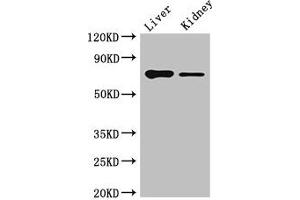 Western Blot Positive WB detected in: Mouse liver tissue, Mouse kidney tissue All lanes: DEF6 antibody at 4 μg/mL Secondary Goat polyclonal to rabbit IgG at 1/50000 dilution Predicted band size: 74 kDa Observed band size: 74 kDa (DEF6 Antikörper  (AA 20-114))