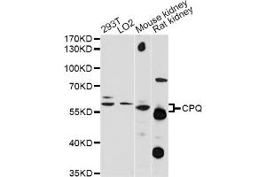 Western blot analysis of extracts of various cell lines, using CPQ antibody (ABIN6293987) at 1:1000 dilution. (CPQ Antikörper)