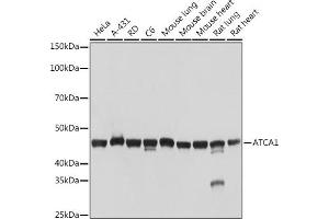 Western blot analysis of extracts of various cell lines, using α-Actin-1  Rabbit mAb (ABIN3015986, ABIN3015987, ABIN1680683 and ABIN1680684) at 1:1000 dilution.