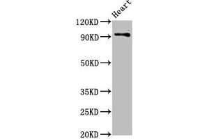 Western Blot Positive WB detected in: Rat heart tissue All lanes: DLG2 antibody at 2. (DLG2 Antikörper  (AA 310-420))