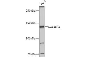 Western blot analysis of extracts of PC-3 cells, using COL16 antibody (8837) at 1:1000 dilution. (COL16A1 Antikörper  (AA 1000-1100))