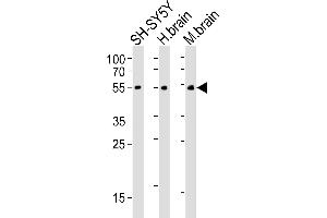 Western blot analysis of lysates from SH-SY5Y cell line, human brain, mouse brain tissue(from left to right), using CHRM2 Antibody (ABIN6242476 and ABIN6577085). (Muscarinic Acetylcholine Receptor M2 Antikörper)