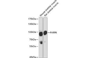 Western blot analysis of extracts of various cell lines, using P antibody (ABIN6133216, ABIN6145242, ABIN6145243 and ABIN6216694) at 1:3000 dilution. (PARP8 Antikörper  (AA 1-300))