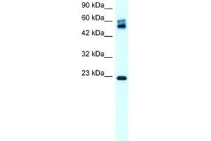 WB Suggested Anti-CLDN8 Antibody Titration:  0. (CLDN8 Antikörper  (C-Term))