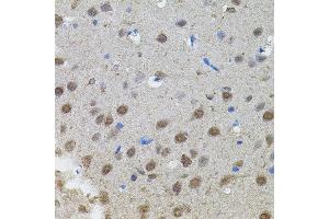Immunohistochemistry of paraffin-embedded rat brain using MYCN antibody.
