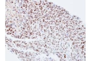 IHC-P Image Immunohistochemical analysis of paraffin-embedded H1299 xenograft, using KPNA4, antibody at 1:500 dilution. (KPNA4 Antikörper  (C-Term))