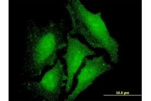 Immunofluorescence of monoclonal antibody to LMO3 on HeLa cell. (LMO3 Antikörper  (AA 91-146))