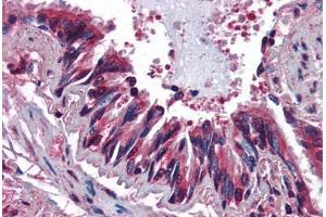 Human Lung, Respiratory Epithelium (formalin-fixed, paraffin-embedded) stained with CCR3 antibody ABIN364440 at 10 ug/ml followed by biotinylated anti-mouse IgG secondary antibody ABIN481714, alkaline phosphatase-streptavidin and chromogen.