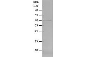 DMC1 Protein (AA 1-176) (His-IF2DI Tag)