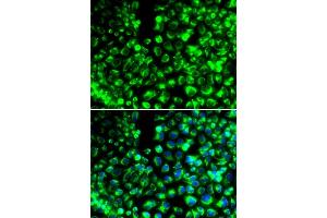 Immunofluorescence analysis of HeLa cells using CALU antibody (ABIN6129532, ABIN6137877, ABIN6137879 and ABIN6216027). (CALU Antikörper  (AA 20-315))