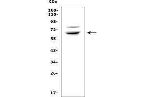 Western blot analysis of RNF168 using anti-RNF168 antibody (ABIN7601889).