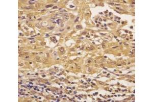 Immunohistochemistry (IHC) image for anti-Argininosuccinate Synthase 1 (ASS1) (AA 192-221) antibody (ABIN3030022)