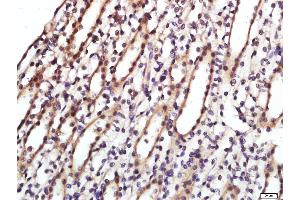 Immunohistochemistry (Paraffin-embedded Sections) (IHC (p)) image for anti-CD9 (CD9) (AA 101-200) antibody (ABIN741015)