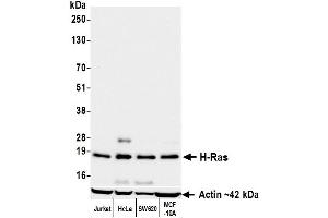 Western Blotting (WB) image for anti-HRas proto-oncogene, GTPase (HRAS) (AA 50-100) antibody (ABIN7795770)